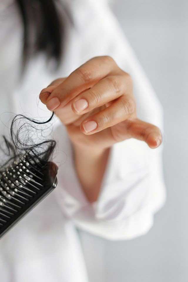PRP ریزش مو چیست؟