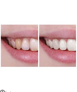 خمیر دندان سفید کننده سنسوداین مدل SanftweiB اصل انگلیس - Sensodyne SanftweiB8