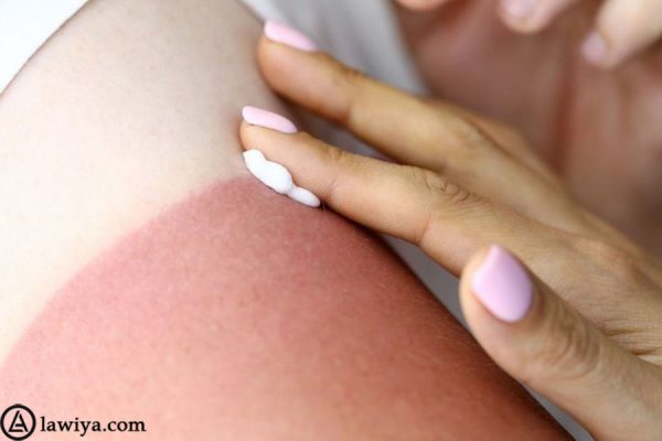 یکی از عامل هایی که باعث آفتاب سوختگی، بیماری پوستی و پیری زود رس در پوست می شود: